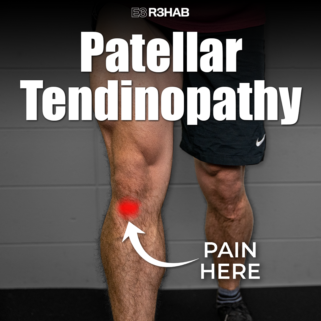 Patellar Tendinopathy E Rehab