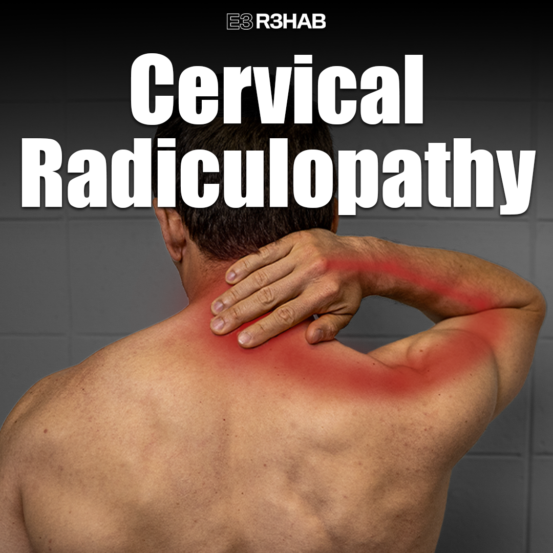 Cervical Radiculopathy E3 Rehab