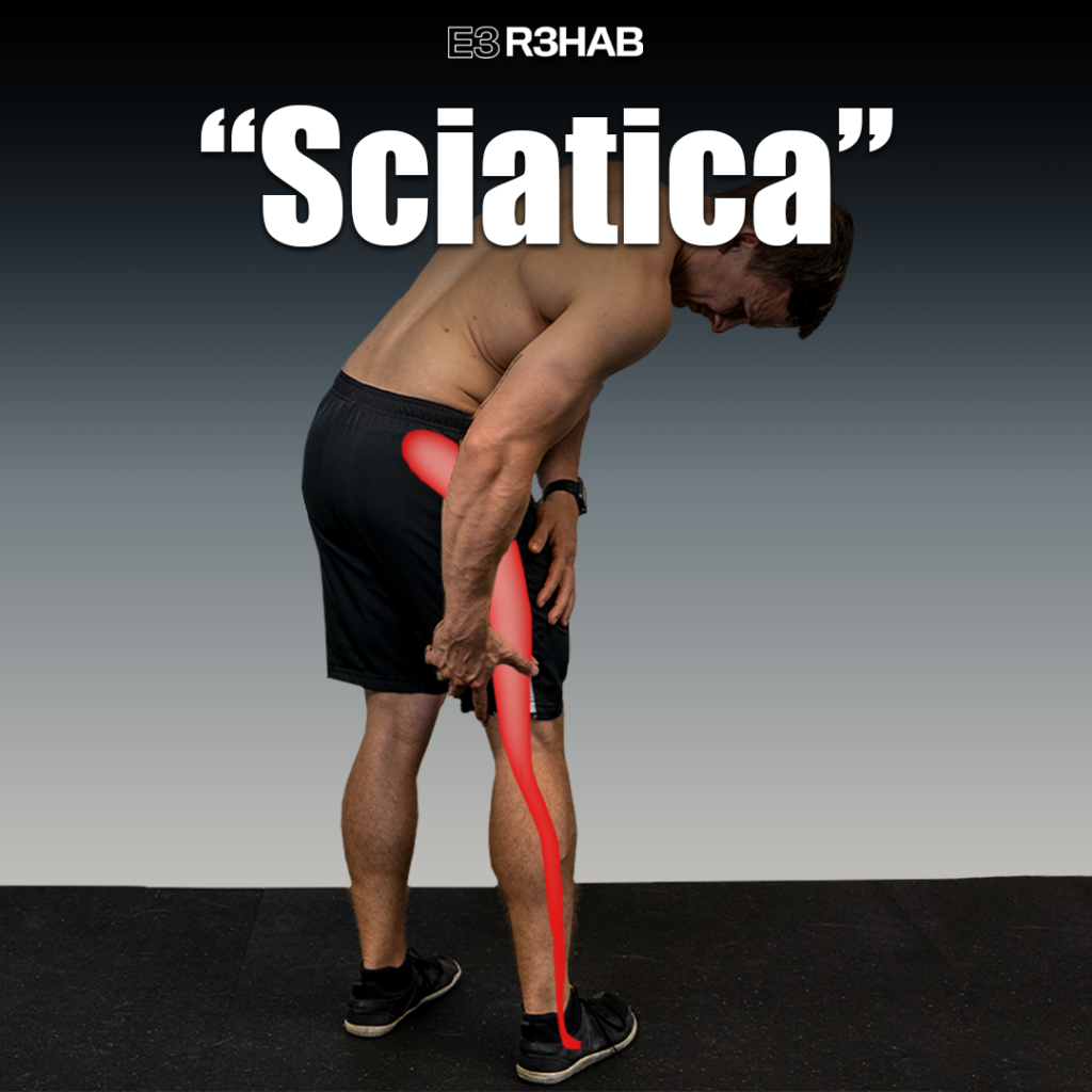 Sciatica Advice - E3 Rehab