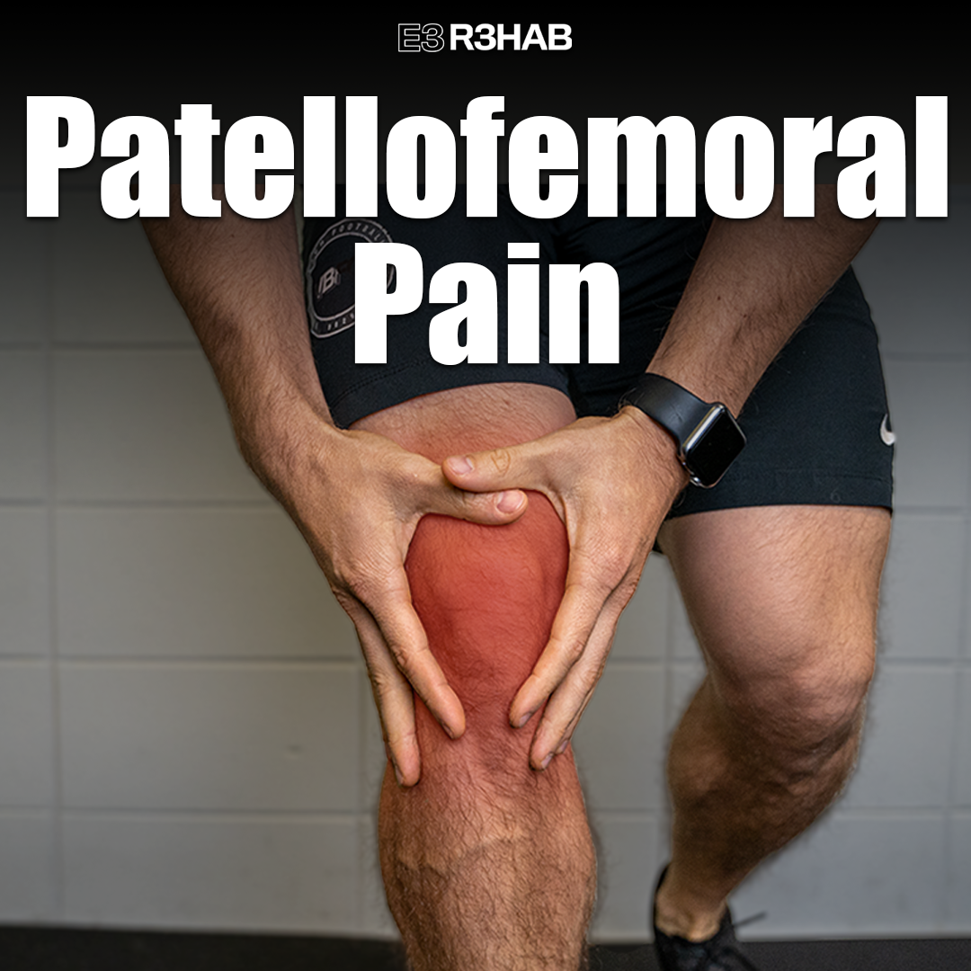 Patellofemoral Pain - E3 Rehab