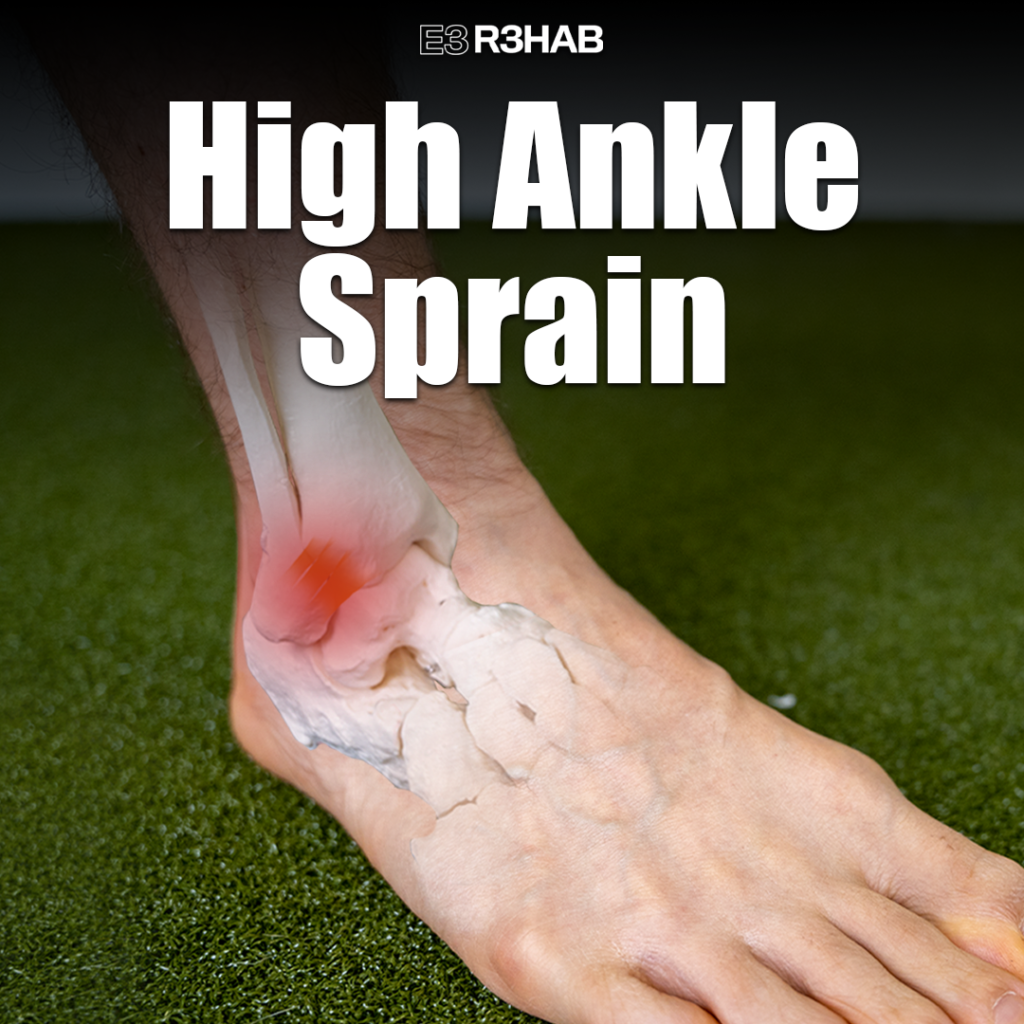 High Ankle Sprain - E3 Rehab