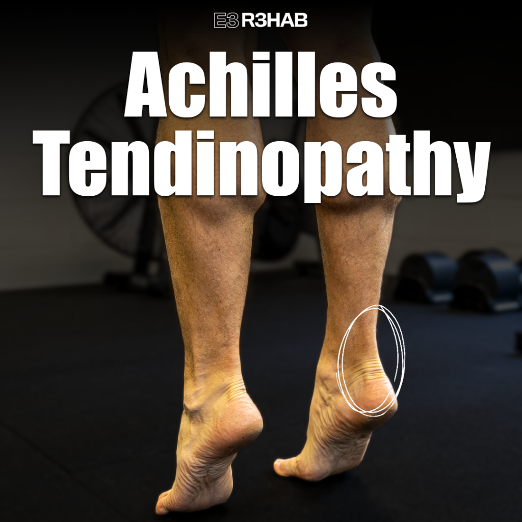 Achilles Tendinopathy - E3 Rehab