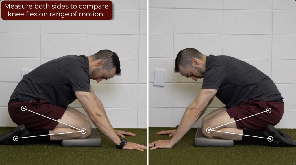 How to Measure Knee Flexion at Home: 8 Steps (with Pictures)