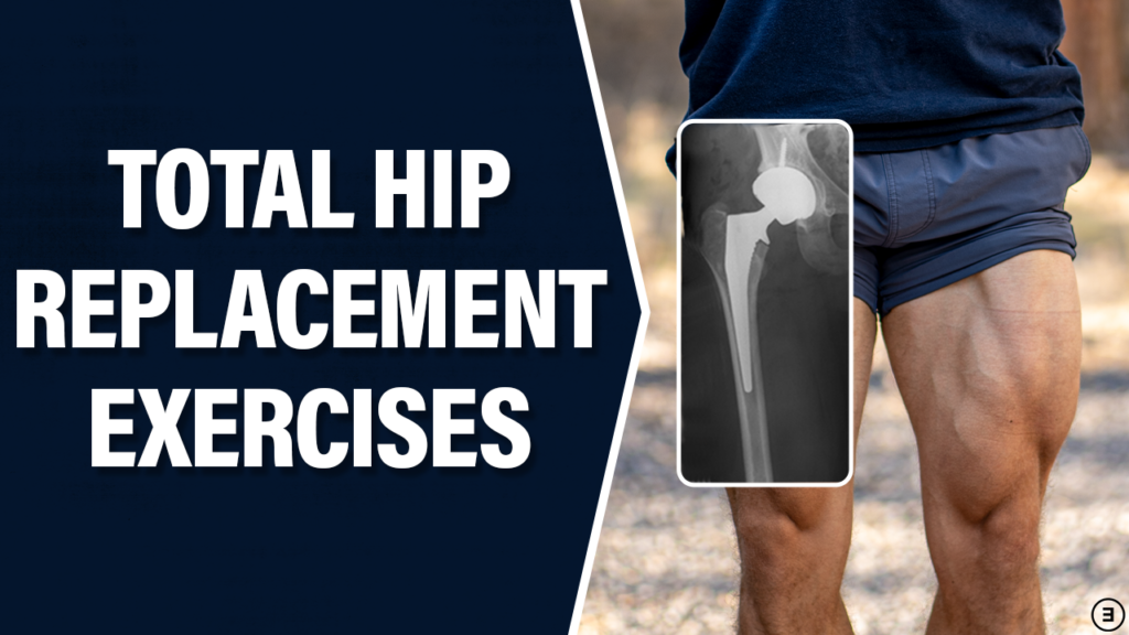 Best Exercises After Total Hip Replacement Surgery - E3 Rehab