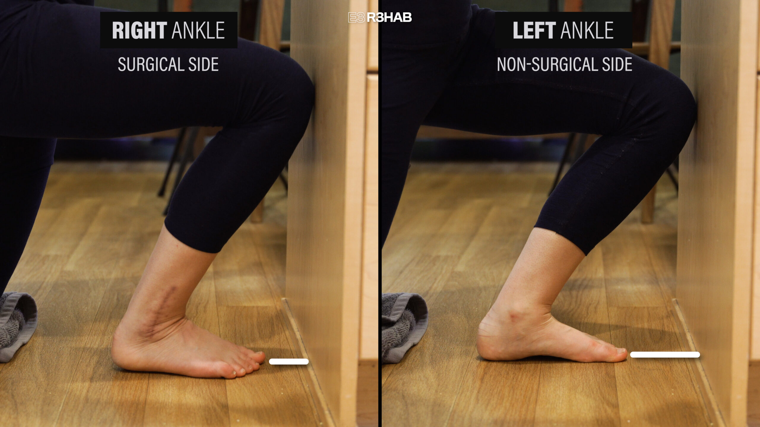 How to Improve Ankle Dorsiflexion Fewer Injuries and Better Performance —  Evolve Performance Healthcare, Molalla Chiropractor